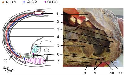 A Review of the Quadratus Lumborum Block and ERAS